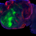  (S. Pașca lab, Stanford University/Reprodução)